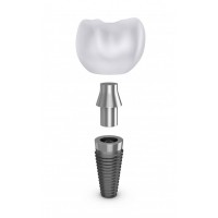 ПРОТЕЗУВАННЯ НА ІМПЛАНТАХ (ОРТОПЕДІЯ)