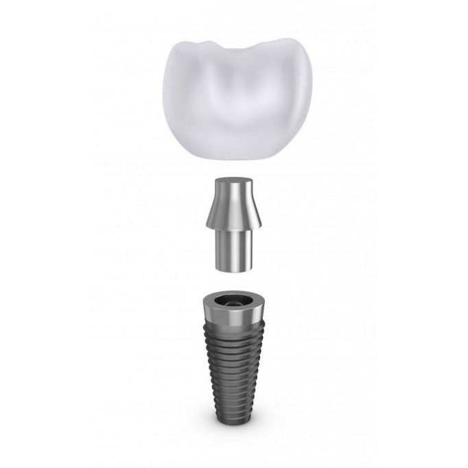 Етапи втановлення імплантантів 