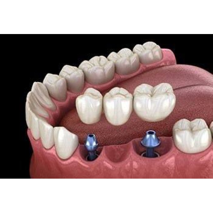 Ортопедія в Домі Стоматології в м.Луцьк