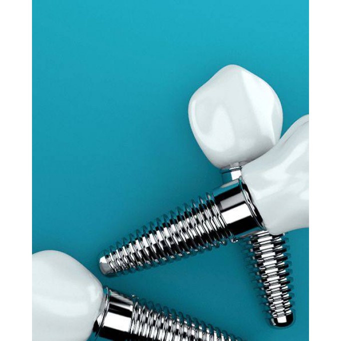 Які переваги установки імплантатів ?