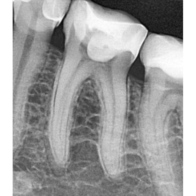 За призначенням лікаря-стоматолога або за терапевтичними показаннями: