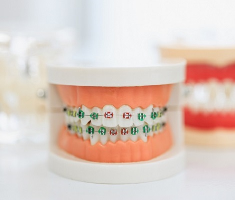 ОРТОДОНТІЯ 